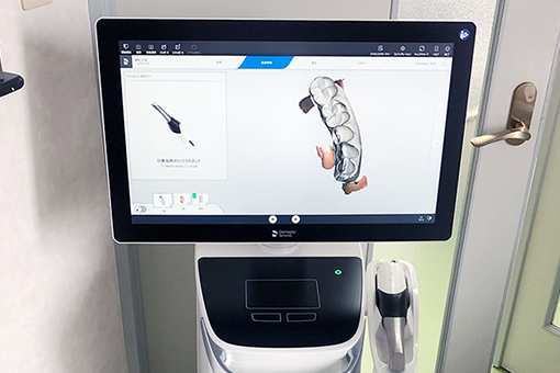 セレックシステム